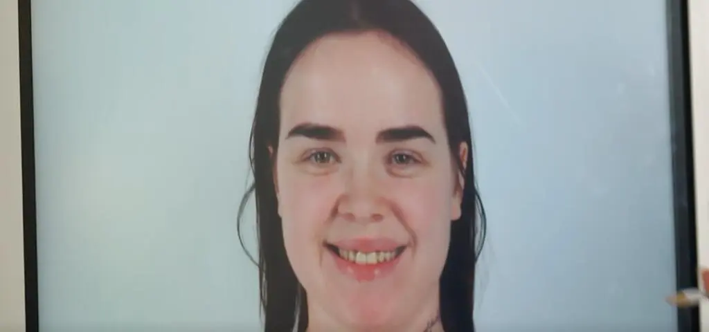 "Bez kompleksów". 28-letnia Weronika pożegnała się z bólem. Co wydarzyło się w 3. odcinku?