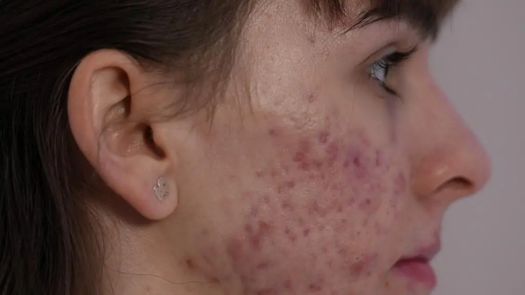 Anatomia piękna, odcinek 1: Adrianna przed zabiegiem