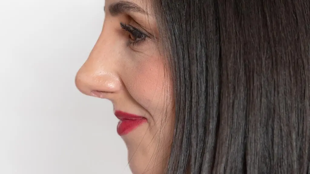 Anatomia piękna, odcinek 1: Natalia po operacji