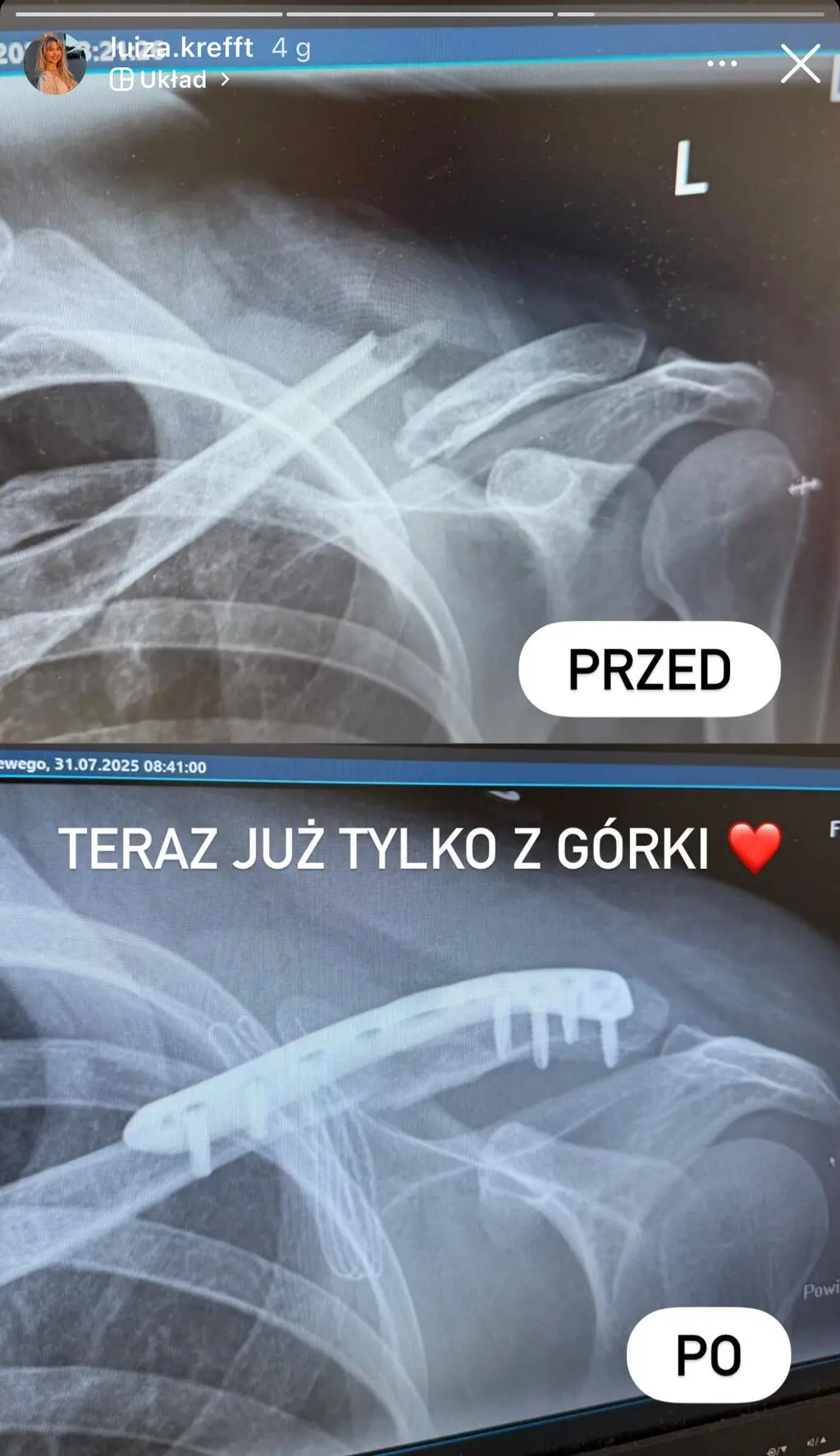 Luiza Krefft z programu "Hotel Paradise"