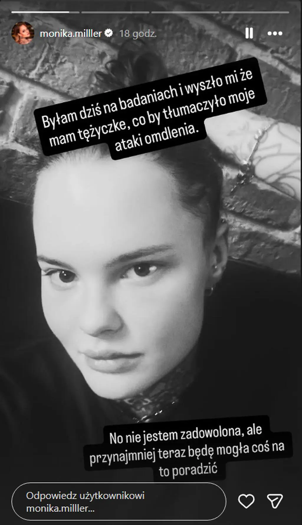 Monika Miller podzieliła się diagnozą