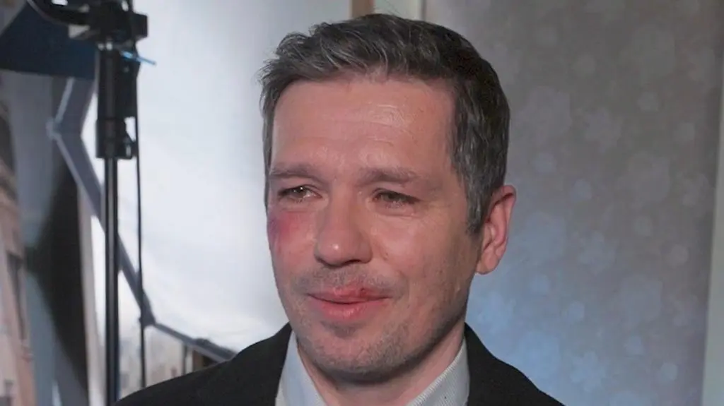 "Na Wspólnej", Alan