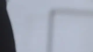 Anatomia piękna: Bartek poddany zabiegowi laserowemu 