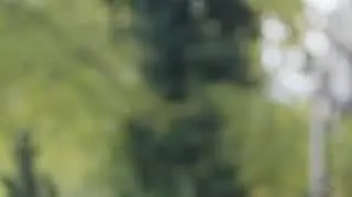 Anatomia piękna: Martyna po zabiegu