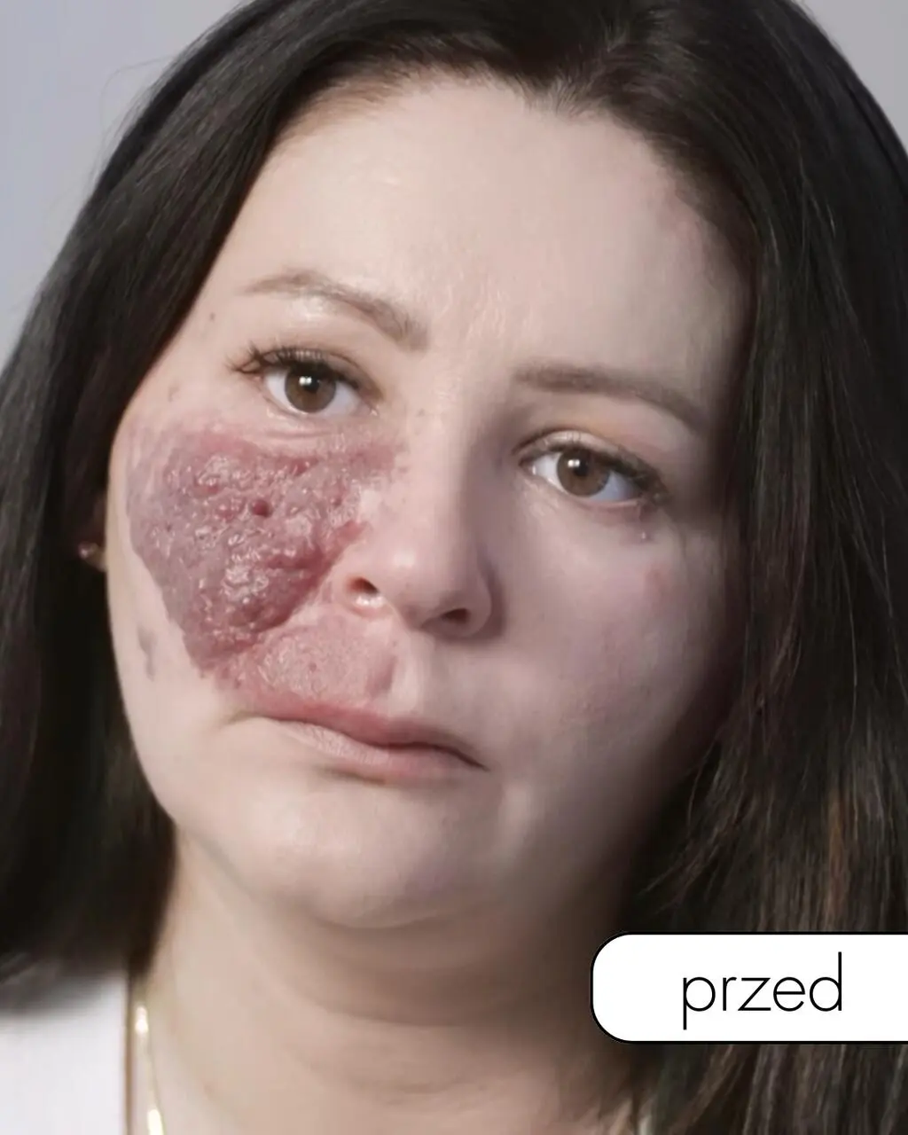 "Anatomia piękna 2"