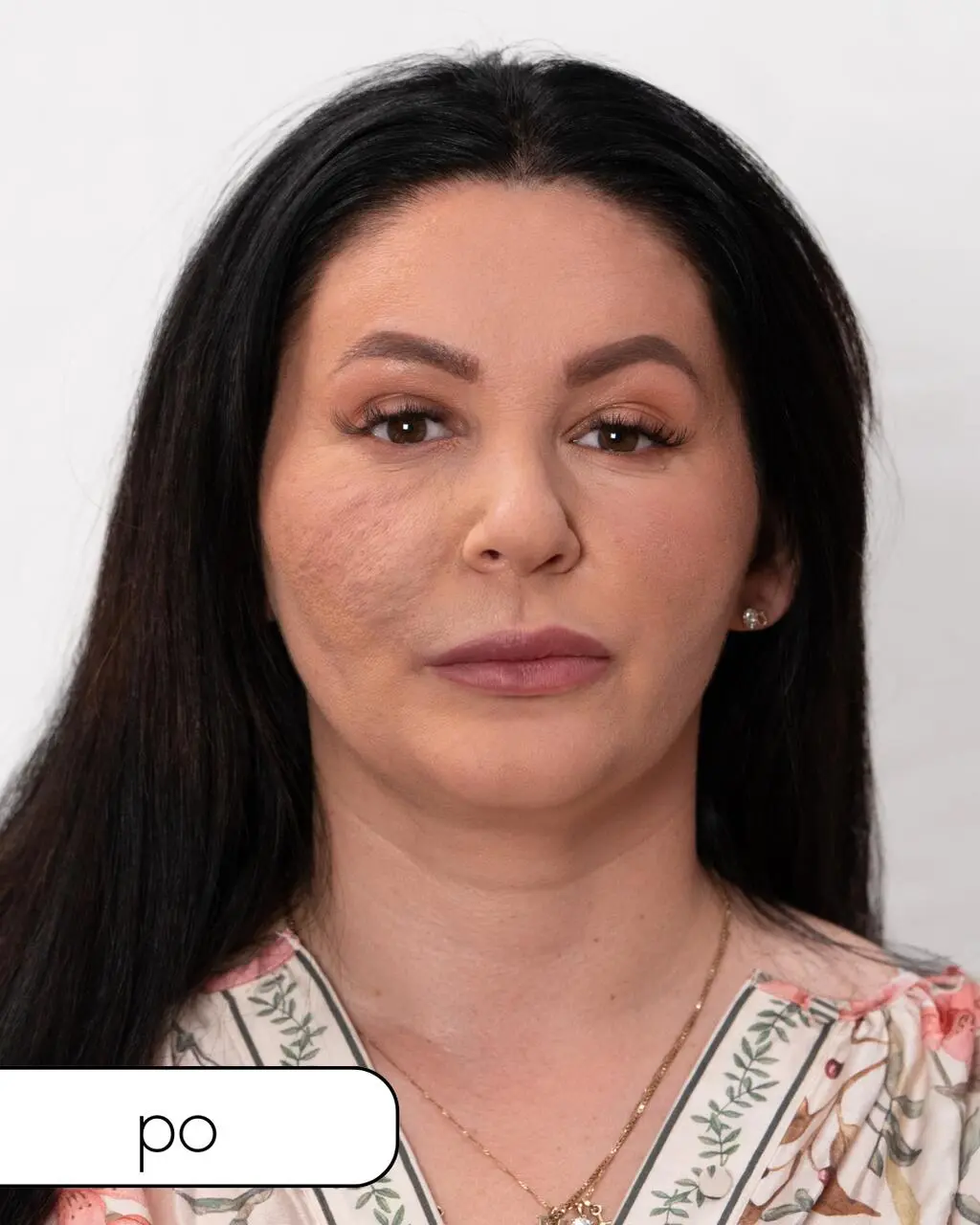"Anatomia piękna 2"