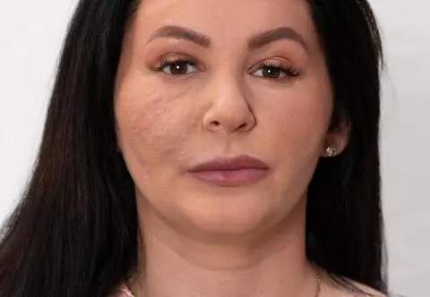 Marta i Bartek wstydzili się swojego wyglądu. Jak pomogli im lekarze z "Anatomii piękna"? Zobacz metamorfozy uczestników!