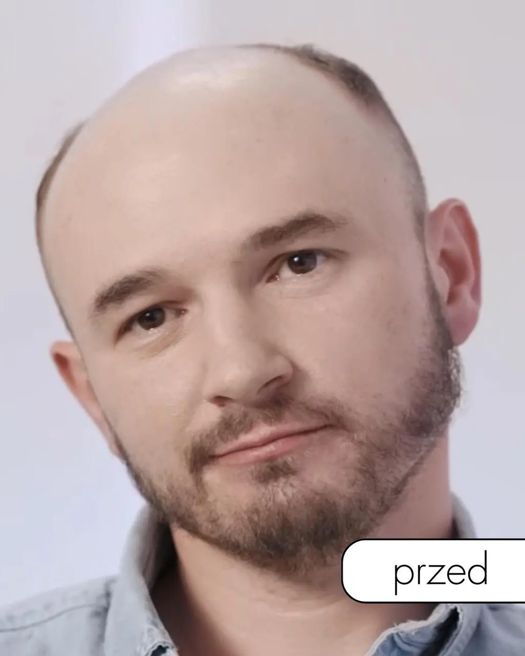 "Anatomia piękna 2