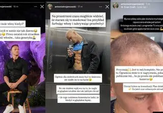 Antek z "Hotelu Paradise" zmienił się nie do poznania.  "Wyglądam zupełnie nie tak, jakbym chciał"