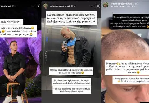 Antek z "Hotelu Paradise" zmienił się nie do poznania.  "Wyglądam zupełnie nie tak, jakbym chciał"