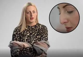 "Bez kompleksów". Ewelina ukrywa przed światem część twarzy. Kim jest uczestniczka 4. odcinka?