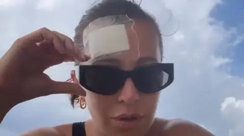 Malwina Wędzikowska uległa wypadkowi na wakacjach. "Kilkadziesiąt godzin koszmaru"