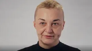 Ania zmaga się z paradontozą i brakiem małżowiny usznej. "Ludzie myśleli, że to przez używki" 