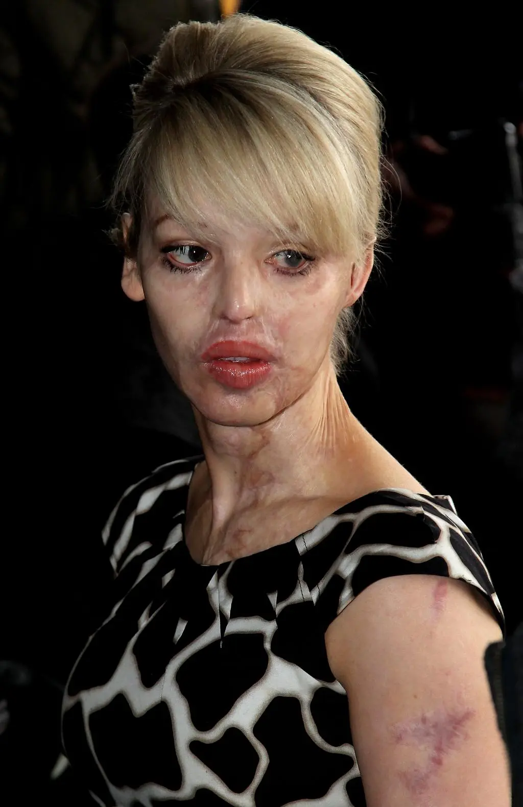 Katie Piper