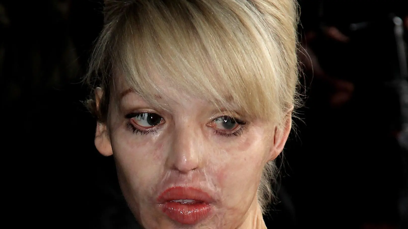 Atak kwasem zrujnował jej życie. Katie Piper kończy 43. lata