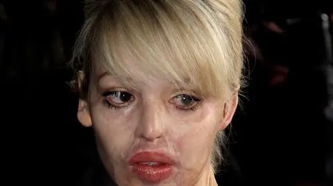 Katie Piper