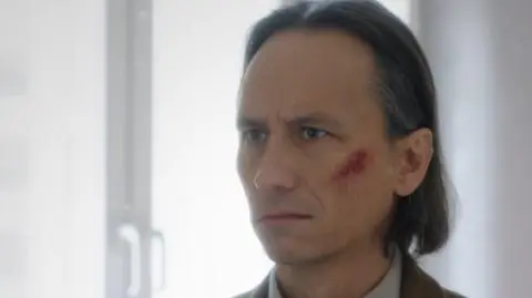 Herkules: Piękne obojczyki i siniak!