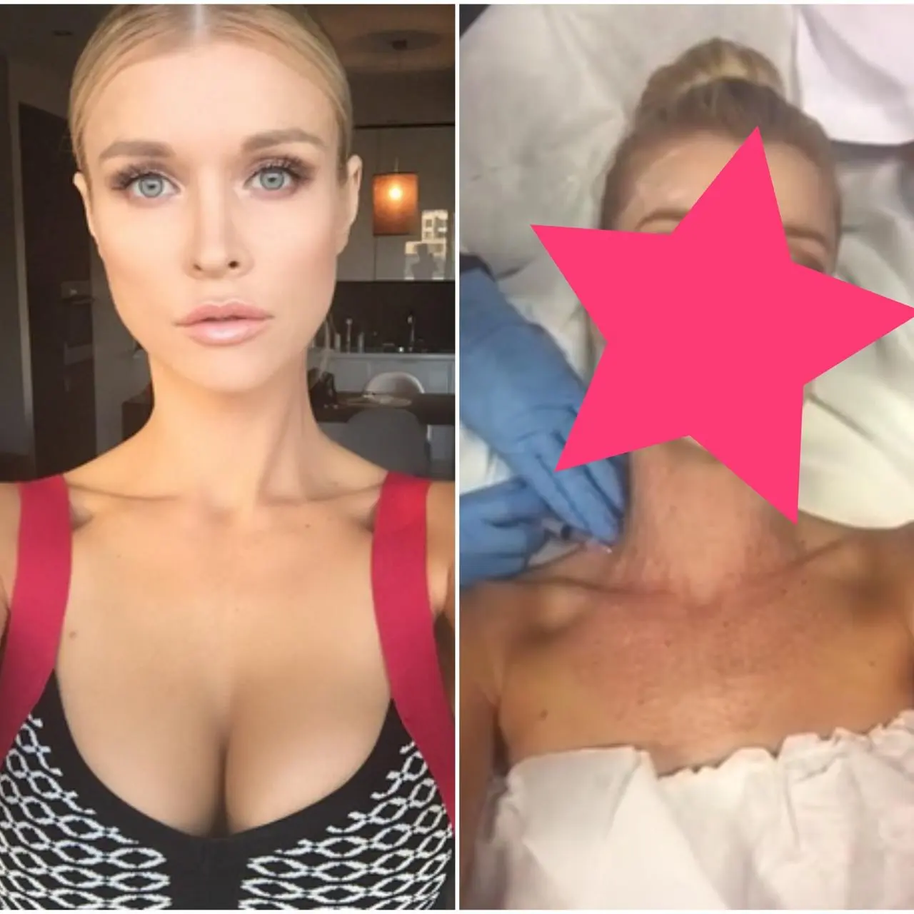 Joanna Krupa znów pokazuje twarz po 