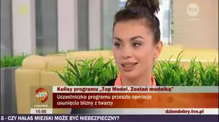 Ania Koryto usunęła bliznę!