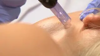 Agata Młynarska na zabiegu