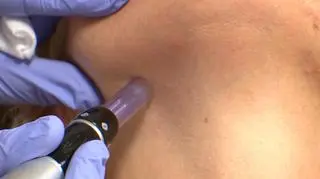 Agata Młynarska na zabiegu