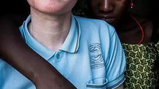 Albinosi w Tanzanii