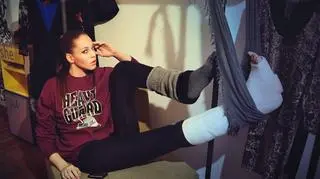 Anna Bałon pozuje z nogą w gipsie!