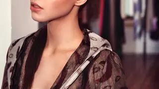 Anna Bałon pozuje z nogą w gipsie!