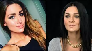Jessica Ziółek przed i po operacji