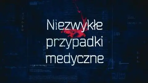 Weź udział w castingu „Niezwykłe przypadki medyczne”