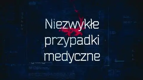 Niezwykłe przypadki medyczne