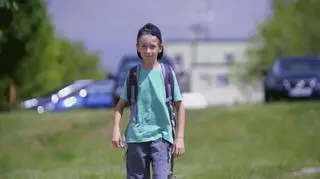 "Życie bez wstydu": chłopiec wyśmiewany przez rówieśników z powodu blizny