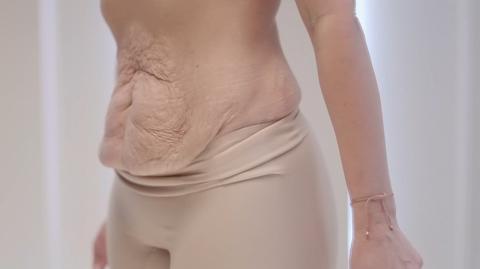 Bohaterka "Anatomii piękna" o bolesnym kompleksie. "Nie mam brzucha, mam worek"