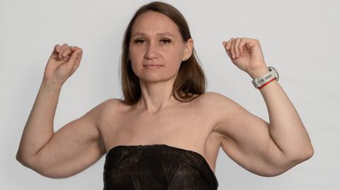 "Anatomia piękna 2." "Pelikany" zamiast ładnych ramiona. Patrycja wstydzi się swojego ciała [PRZED EMISJĄ W TV]