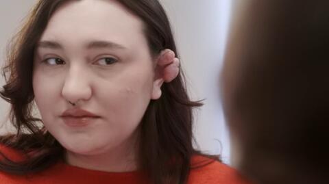 "Anatomia piękna 2". Julia nie mogła patrzeć w lustro. Wszystko zaczęło się od kolczyka [PRZED EMISJĄ W TV]